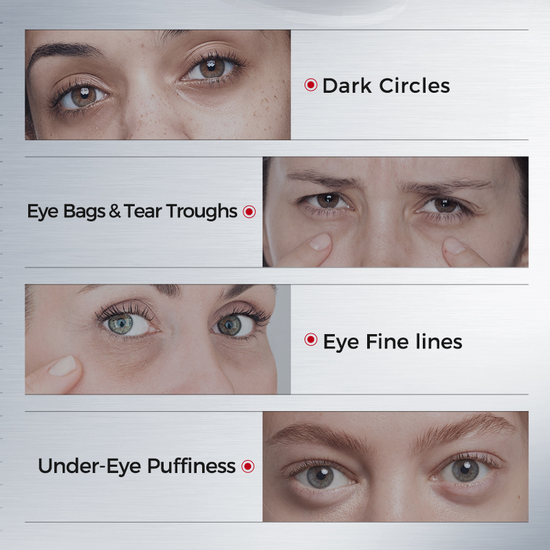 Augenpads gegen Augenringe – S – Collagen Under Eye Patches Bewertung und Preis