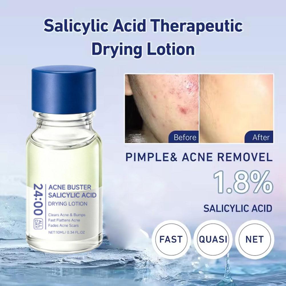 Salicylsäure Akne-Bekämpfer En – Salicylic Acid Blackhead Remover Bewertung und Preis